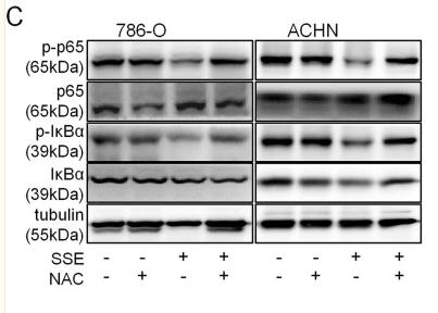 NF-kB p65 Antibody - Fig.