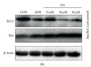 Bcl-2 Antibody - Figure 4
Effect of GA on the mitochondrial pathway of H9C2 cells.