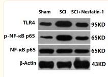 NF-kB p65 Antibody - FIGURE 7
Nesfatin‐1 prevented activation of NF‐κB signaling in SCI mice.