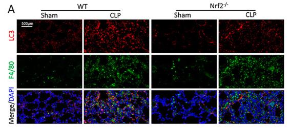 LC3A/B Antibody - Figure 5
Nrf2 deficiency inhibits CLP-induced upregulation of autophagy level in lung tissues; n = 6 mice per group.
