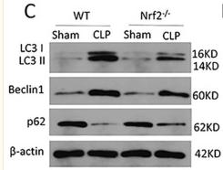 LC3A/B Antibody - Figure 5
Nrf2 deficiency inhibits CLP-induced upregulation of autophagy level in lung tissues; n = 6 mice per group.