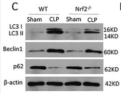 Beclin 1 Antibody - Figure 5
Nrf2 deficiency inhibits CLP-induced upregulation of autophagy level in lung tissues; n = 6 mice per group.