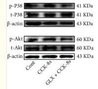 Phospho-AKT1/2/3 (Ser473) Antibody - Figure 4
Effects of p38 MAPK and Akt on ANP secretion and dynamics induced by CCK-8s in isolated beating rat atria.