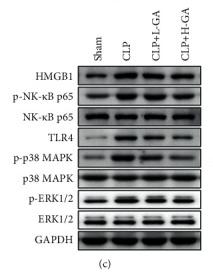 GAPDH Antibody - Figure 5
The expression degrees of HMGB1, TLR4, NF-κB, p-38 MAPK, and ERK1/2 proteins (x¯ ±s).