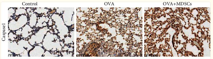 Caspase 1 Antibody - Figure 9
The expression of caspase 1 and caspase 3 in lung tissues was detected by immunohistochemistry.