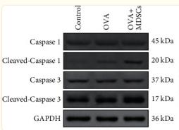 GAPDH Antibody - Figure 10
The expressions of cleaved caspase 1/caspase 1 and cleaved caspase 3/caspase 3 in lung tissues were detected by western blot.