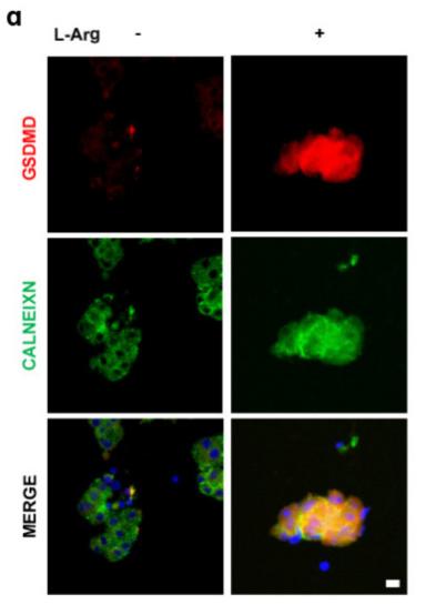 GSDMD Antibody - Figure 1
L-arginine induces the accumulation of GSDMD in endoplasmic reticulum of acinar cells.