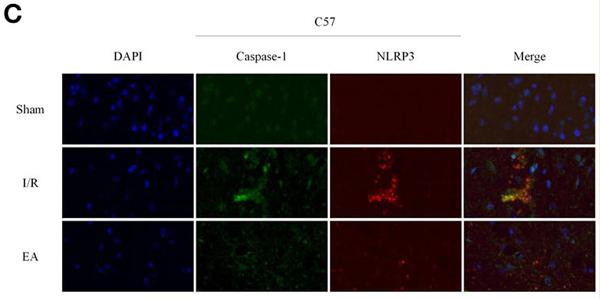 NLRP3 Antibody - Figure 3
Morphological observation of neuronal injury in hippocampus after I/R injury.