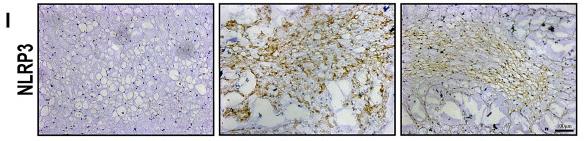 NLRP3 Antibody - FIGURE 6
Scutellarin alleviates the degeneration of IVD in a rat IVDD model.