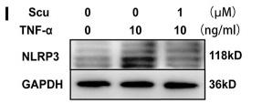 NLRP3 Antibody - FIGURE 7
Scutellarin inhibited the NF-κB/MAPK signaling pathways and suppressed activation of the NLRP3 inflammasome in HNPCs.