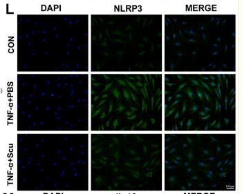 NLRP3 Antibody - FIGURE 7
Scutellarin inhibited the NF-κB/MAPK signaling pathways and suppressed activation of the NLRP3 inflammasome in HNPCs.