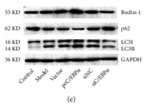 SQSTM1/p62 Antibody - Figure 4 The impact of C/EBPα in angiotensin II- (Ang II-) treated VSMCs.
