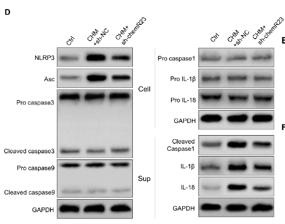 Cleaved-IL-1 beta (Asp116) Antibody - Figure 4.