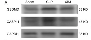 GSDMD Antibody - "FIGURE 6
XBJ reduced the expression of caspase-11 and GSDMD in septic mice.