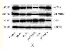 GAPDH Antibody - Figure 4 The impact of C/EBPα in angiotensin II- (Ang II-) treated VSMCs.