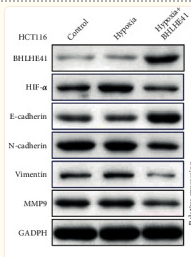 HIF1A Antibody - Figure 8 BHLHE41 overexpression weakened the HIF-1α and EMT-related factor levels in hypoxia-induced CC cells.