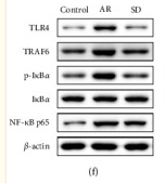 beta Actin Antibody - Figure 4 The effects of SD treatment on the levels of the TLR4/TRAF6/NF-κB and IL-6/ROR-γt/STAT3 pathways' related genes and proteins in the nasal mucosa of AR mice ((n) = 6).
