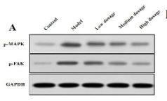 Phospho-FAK (Tyr397) Antibody - 3.