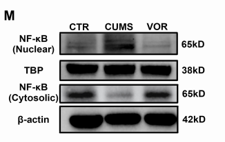 NF-kB p65 Antibody - Figure 4: Changes of IL-1β, IL-6, NF-kB and YY1- mRNA expression in Frontal cortex (A-D), Striatum (E-H), hippocampus (I-L) among CTR (n = 8), CUMS (n = 8) and VOR group (n = 8); (M) Representative western blot image of NF-kB in nuclear level and cytosolic in the hippocampus among CTR, CUMS and VOR groups;.