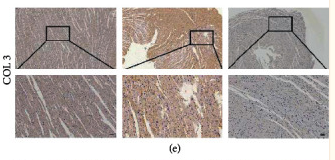 Collagen III Antibody - Figure 3
Effects of SG on diabetic-induced cardiac remodeling.