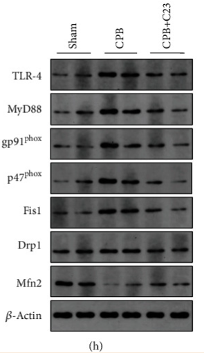 DRP1 Antibody - Figure 3 CPB induced mitochondrial dynamics disorder and increased inflammatory factor secretion.