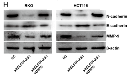 MMP9 Antibody - Figure 2 G6PD is an important target for ELFN1-AS1 (A) Western blot analysis was used to analyse the expression of G6PD in CRC cells transfected with the NC construct or shELFN1-AS1.