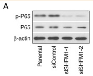 NF-kB p65 Antibody - Figure 7 SHFM1 regulates the NF-κB signaling pathway in ESCC cells.