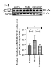 Phospho-mTOR (Ser2448) Antibody - Figure 6.