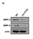MMP2 Antibody - Figure 3 Circ-ITCH inhibits the migration and invasion of PCa cells in vitro.
