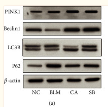 LC3A/B Antibody - Figure 4 Effects of CA on autophagy.
