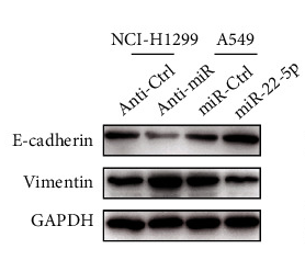 GAPDH Antibody - Figure 2 miR-22-5p regulates NSCLC cell proliferation, migration, invasion, and EMT.