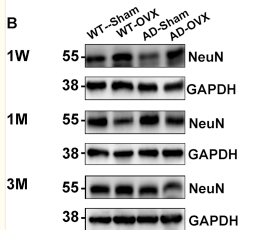 GAPDH Antibody - Figure 4 Estrogen deficiency exacerbates hippocampal neuron loss in mice.