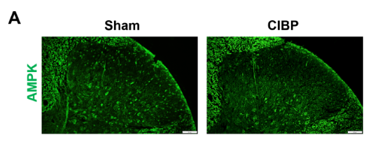 Phospho-DRP1 (Ser616) Antibody - Figure 3 Effect of AICAR treatment on the activities of AMPK and Drp1 (A,B) Representative immunofluorescence staining images of the expression of AMPK and Drp1 in the spinal dorsal horn of sham and CIBP rats.