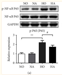 NF-kB p65 Antibody - Figure 5 Relative expression levels of NF-κB pathway-related proteins were measured via western blot assay.