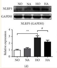 NLRP3 Antibody - Figure 4 mRNA and protein expression levels of NLRP3 inflammasome.