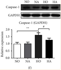 Caspase 1 Antibody - Figure 4 mRNA and protein expression levels of NLRP3 inflammasome.