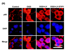 NF-kB p65 Antibody - FIGURE 4 STIP1 restrains OGD-induced inflammation in microglial cells.