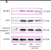 Cleaved-Caspase 1 (Asp296), p20 Antibody - Figure 5 Vav1 knockdown represses inflammation in the ischemic penumbra of MCAO/R rats.