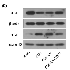 NF-kB p65 Antibody - FIGURE 3 STIP1 ameliorates ischaemia/reperfusion-induced inflammation in rat spinal cord.