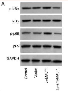 NF-kB p65 Antibody - Figure 5 Effect of MALT1 mucosa-associated lymphoid tissue lymphoma translocation protein 1 on nuclear factor-κB signaling in proatherogenic VSMCs.