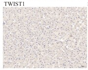 Twist1 Antibody - Figure 5.