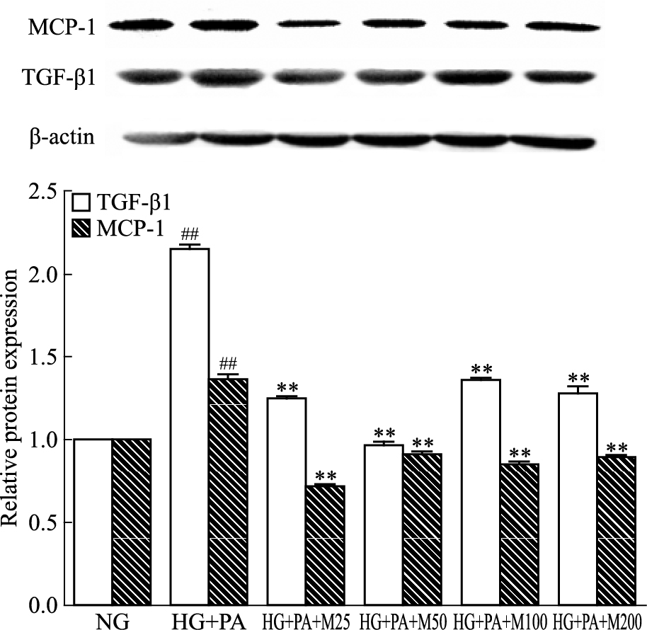 TGF beta 1 Antibody - Fig 2 Effect of marein on expression of TGF-β1 and MCP-1 protein in HBZY-1cells induced by high glucose and palmitic acid.