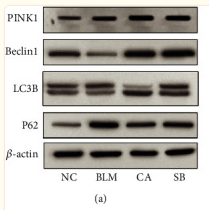 SQSTM1/p62 Antibody - Figure 4 Effects of CA on autophagy.