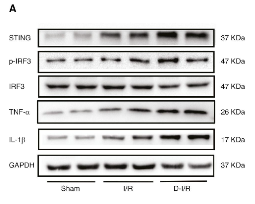 TNF alpha Antibody - Figure 1 Diabetes Aggravates STING-Mediated Inflammation in Hearts.