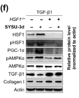 Collagen I Antibody - FIGURE 5 SYSU-3d blocks inflammation and fibrosis in multiple cell models responsible for non-alcoholic steatohepatitis (NASH) in liver.