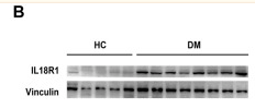 IL18R1 Antibody - FIGURE 4 Expression of IL18R1 in the muscle tissues and blood of IIMs patients.