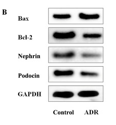 Bcl-2 Antibody - Figure 1 ADR induces podocyte apoptosis and the regulation of miR-199b-5p.