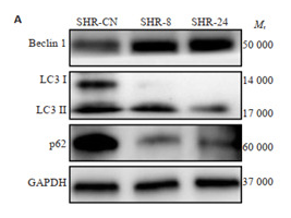 LC3A/B Antibody - 2 热暴露对SHRs胸主动脉自噬蛋白表达的影响 Effect of heat exposure on autophagy in the thoracic aorta of the SHRs.