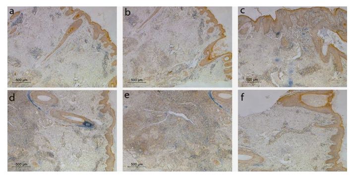 HIF1A Antibody - Fig.