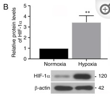 HIF1A Antibody - Figure 1.